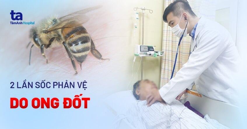 2 lần sốc phản vệ do ong đốt